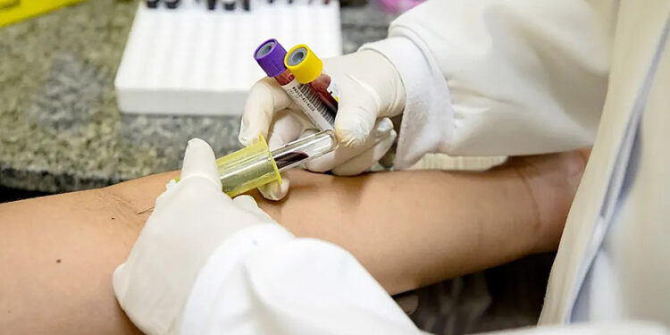 Manaus é destaque nacional na prevenção à tuberculose, informa Ministério da Saúde