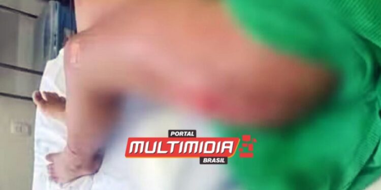 Ex-namorado ciumento usa caminhão para atropelar garota de 16 anos, em Coari