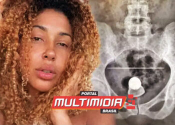 Blogueira é internada após ‘incidente íntimo’ com plug