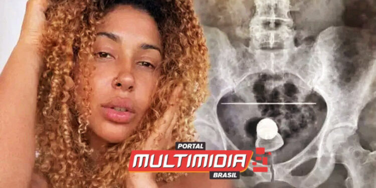 Blogueira é internada após ‘incidente íntimo’ com plug